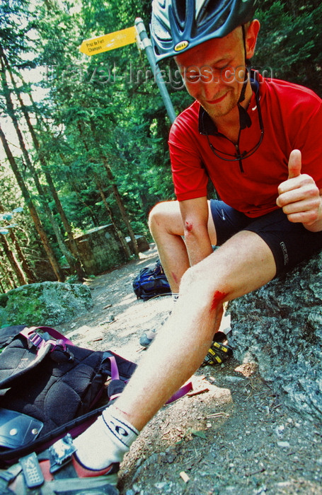 france909: Chamonix, Haute-Savoi, Rhône-Alpes, France: injured but happy mountainbiker - Tour du Mont Blanc trail - photo by S.Egeberg - (c) Travel-Images.com - Stock Photography agency - Image Bank