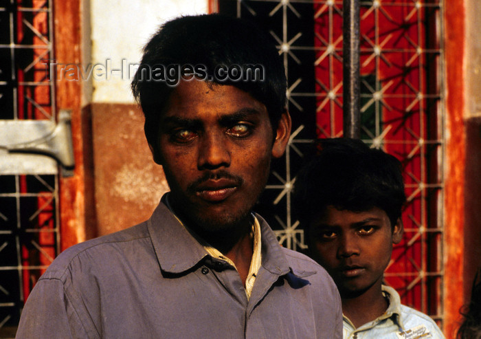 nepal270: Kathmandu, Nepal: blind beggar - photo by W.Allgöwer - (c) Travel-Images.com - Stock Photography agency - Image Bank