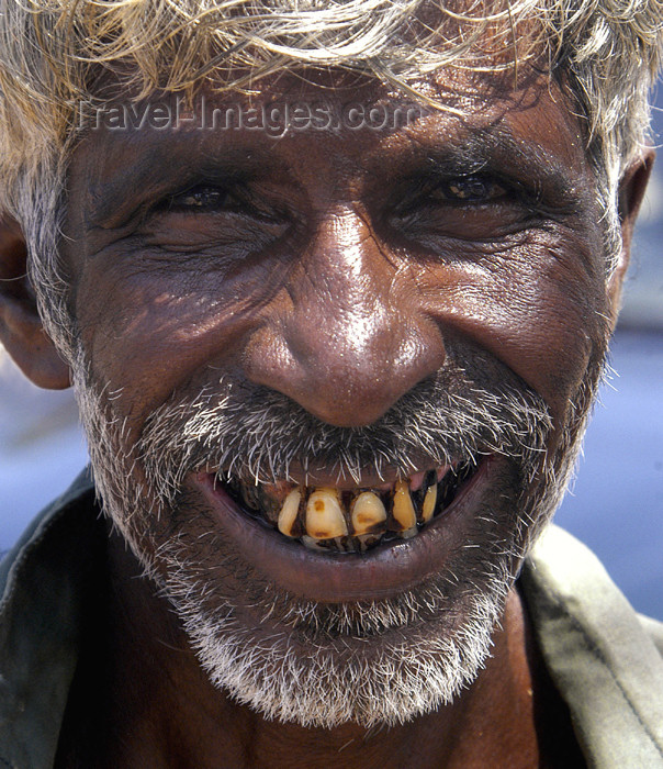 sri-lanka83: Sri Lanka Local dentist, near Weligama (photo by B.Cain) - (c) Travel-Images.com - Stock Photography agency - Image Bank