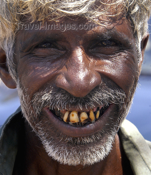 sri-lanka83: Sri Lanka Local dentist, near Weligama (photo by B.Cain) - (c) Travel-Images.com - Stock Photography agency - Image Bank