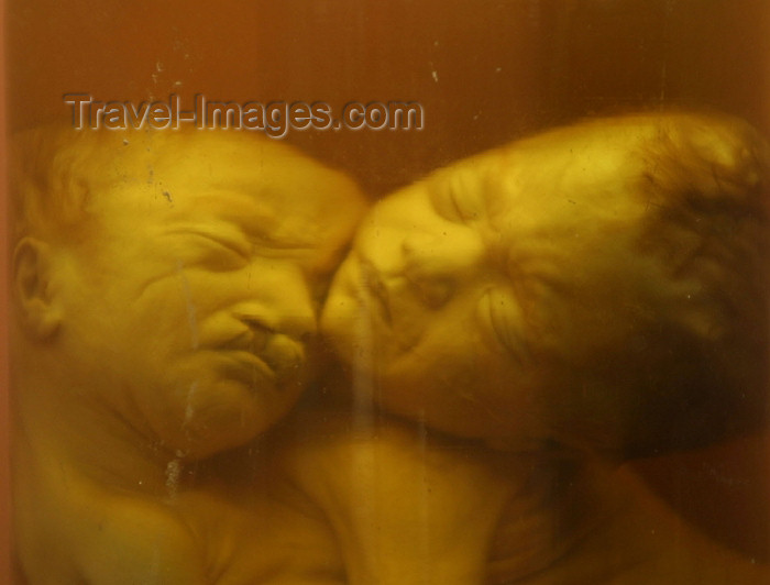 vietnam22: Vietnam - Ho Chi Minh city / Saigon: deformed stillborn children - the result of Agent Orange - War Remnants Museum (photo by Rod Eime) - (c) Travel-Images.com - Stock Photography agency - Image Bank